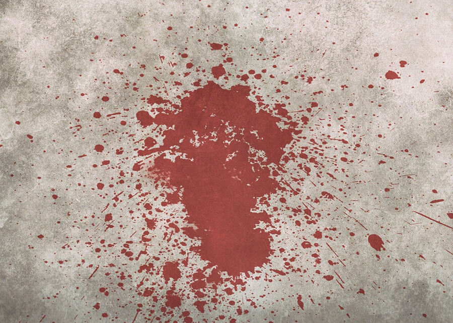 Blood Stain on Carpet